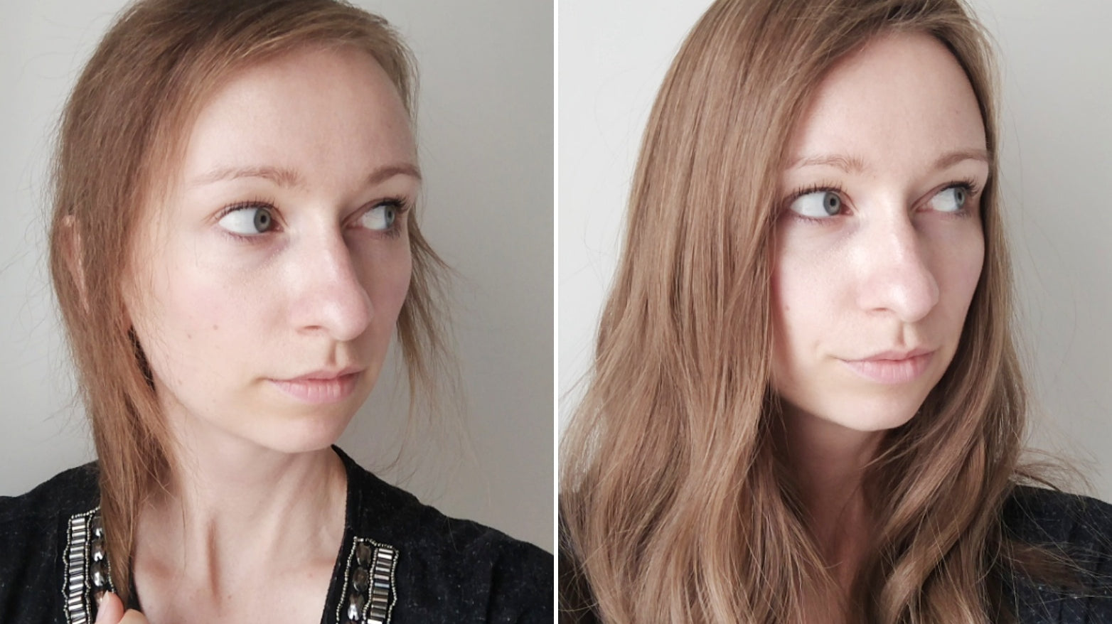 Perücke, Topper, Toupet - welcher Haarersatz ist der richtige für mich?