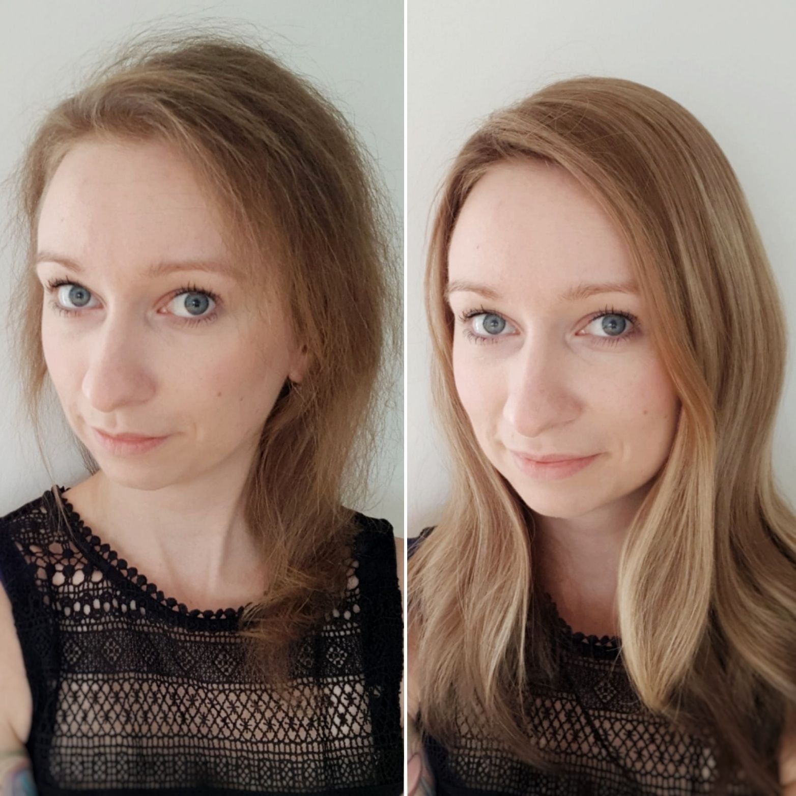 Selbstbewusst trotz Haarausfall: Wie geht das? - Glückssträhnen