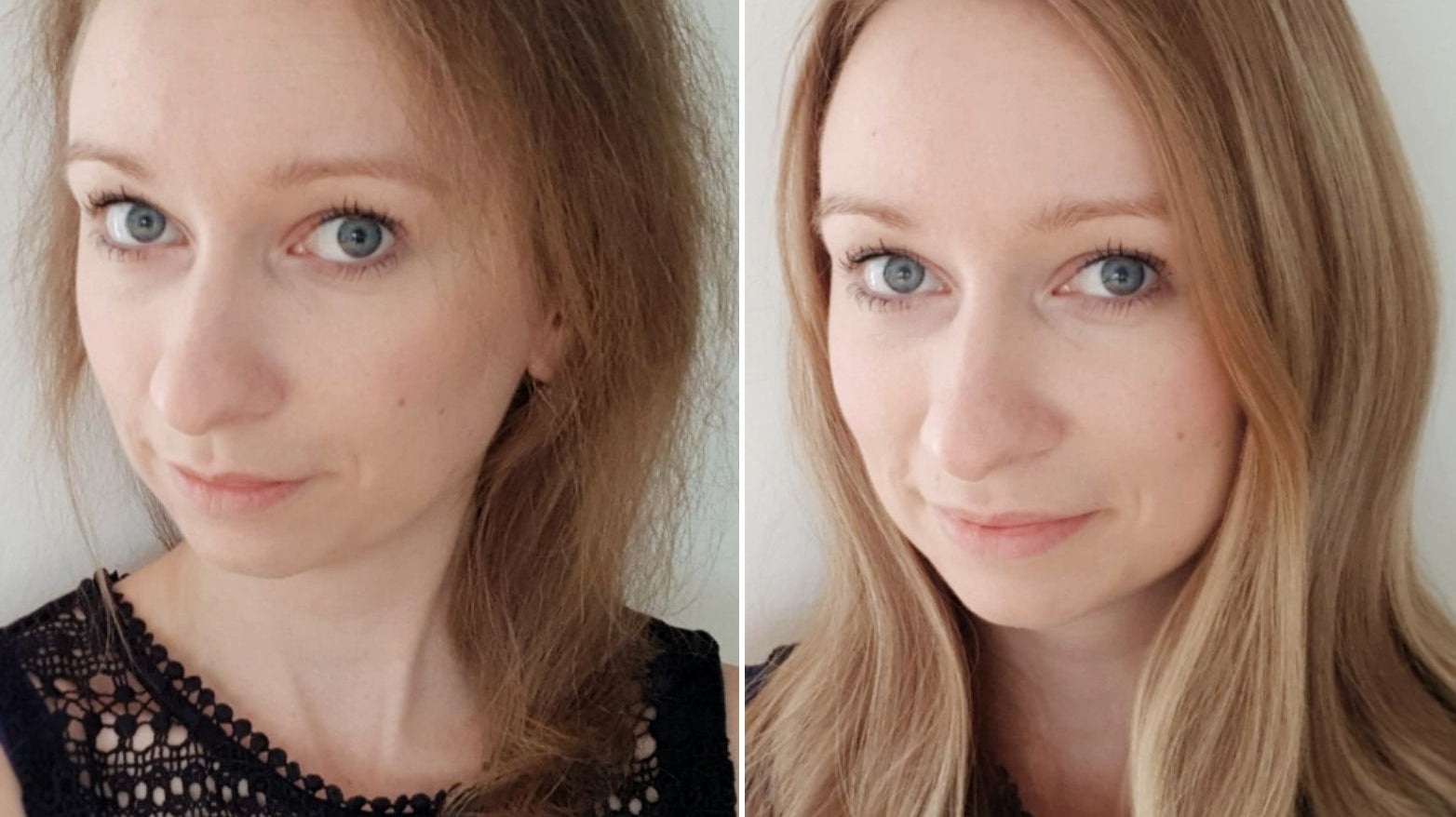 Selbstbewusst trotz Haarausfall: Wie geht das?