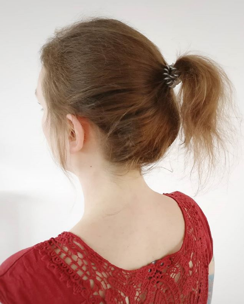 Hilfsmittelzuschuss: So bezahlt die Krankenkasse dein Haarteil